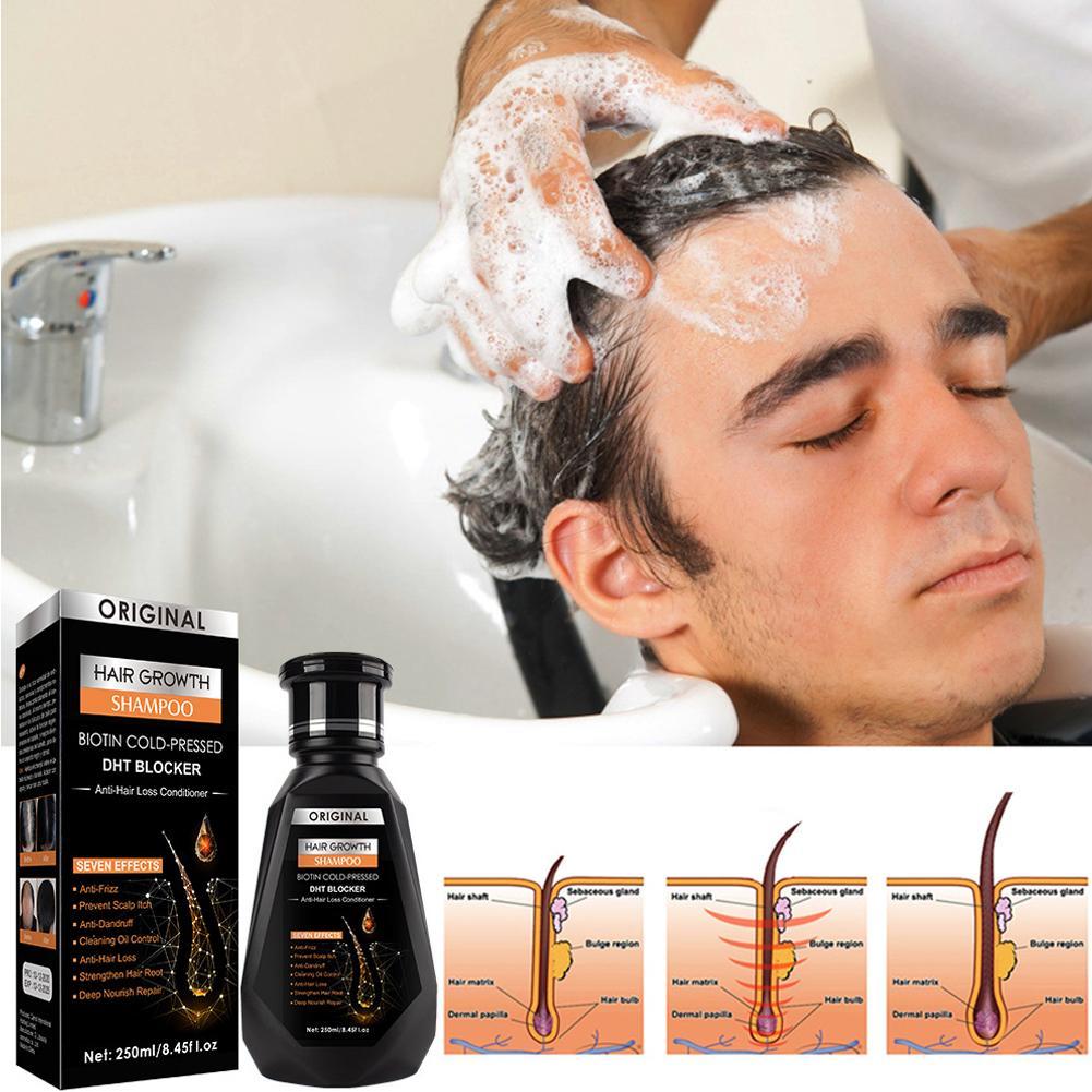 250ML Biotin Shampoo For Hair  - Biotin Shampoo Thickening review and price