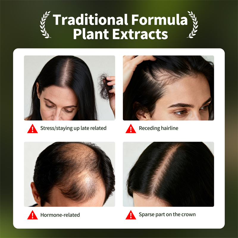 Natural Hair Growth Set Usman  - Hair Care Oil Serum review and price