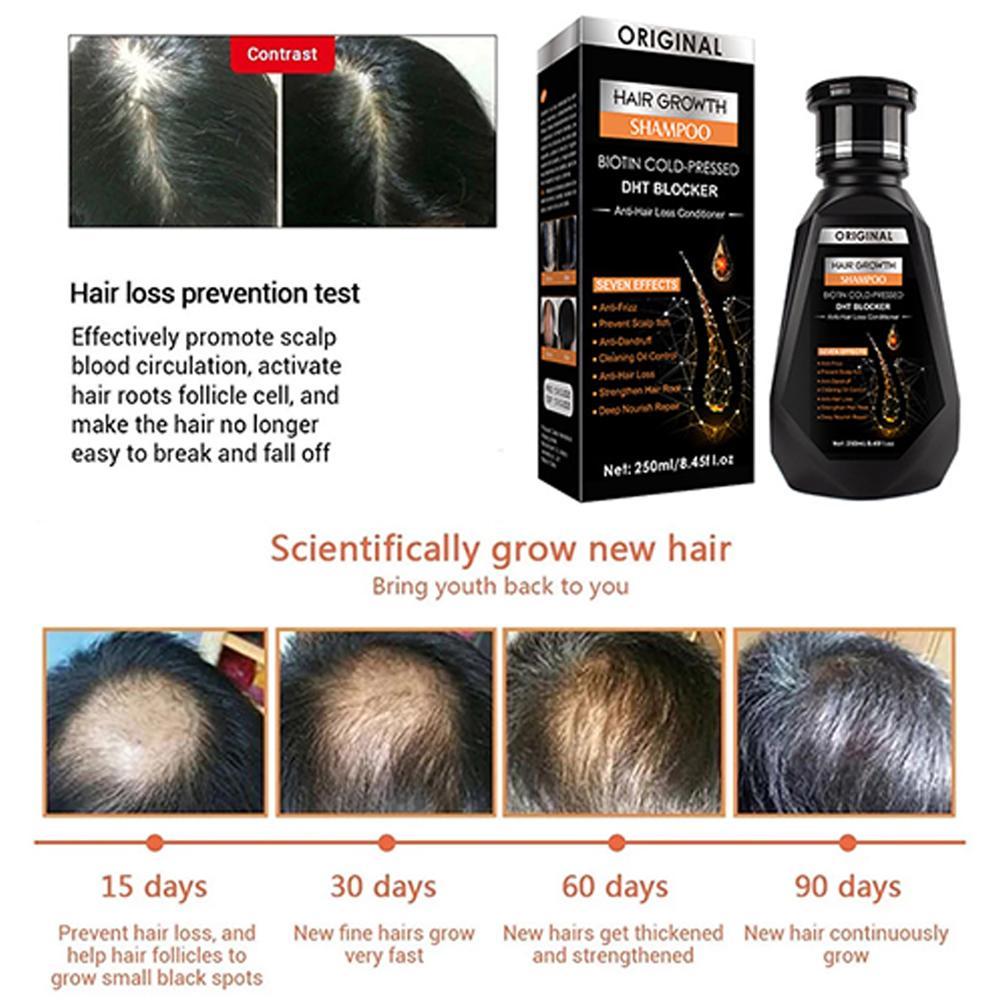 Biotin Ginger shampoo Thickeni - Biotin Shampoo Thickening review and price