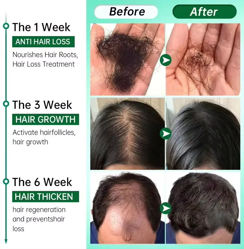 Hair Growth Serum 7 Days Fast  - Hair Care Oil Serum review and price
