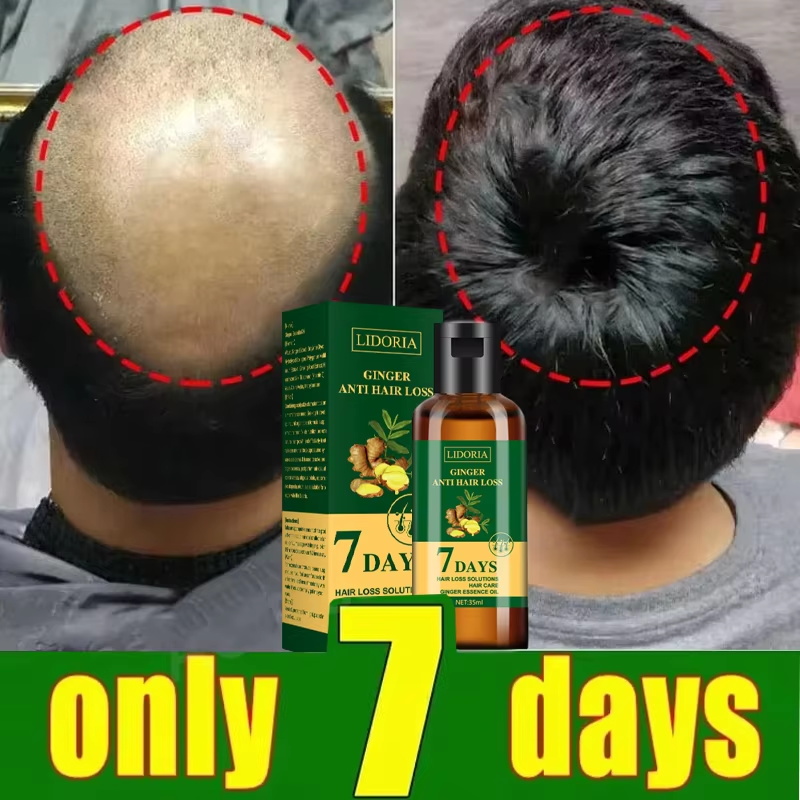 Hair Growth Serum 7 Days Fast  - Hair Care Oil Serum review and price