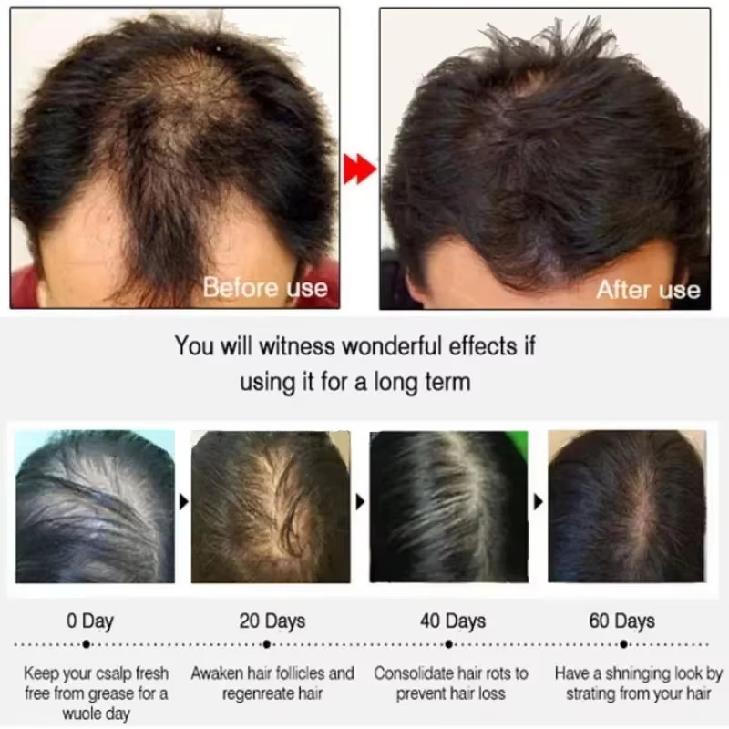 Hair Growth Serum 7 Days Fast  - Hair Care Oil Serum review and price