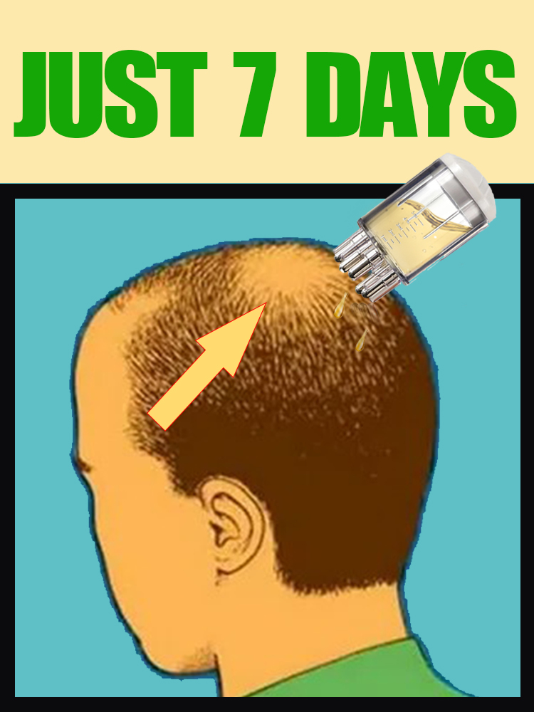 2025 NEW UPGRADE Scalp Applica - Hair Care Oil Serum review and price