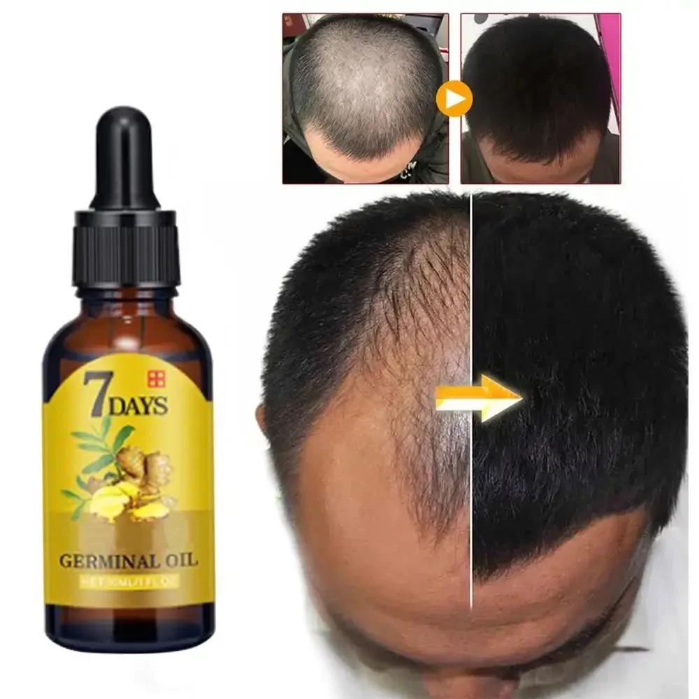 Hair Growth Ginger Fast Growin - Hair Care Oil Serum review and price