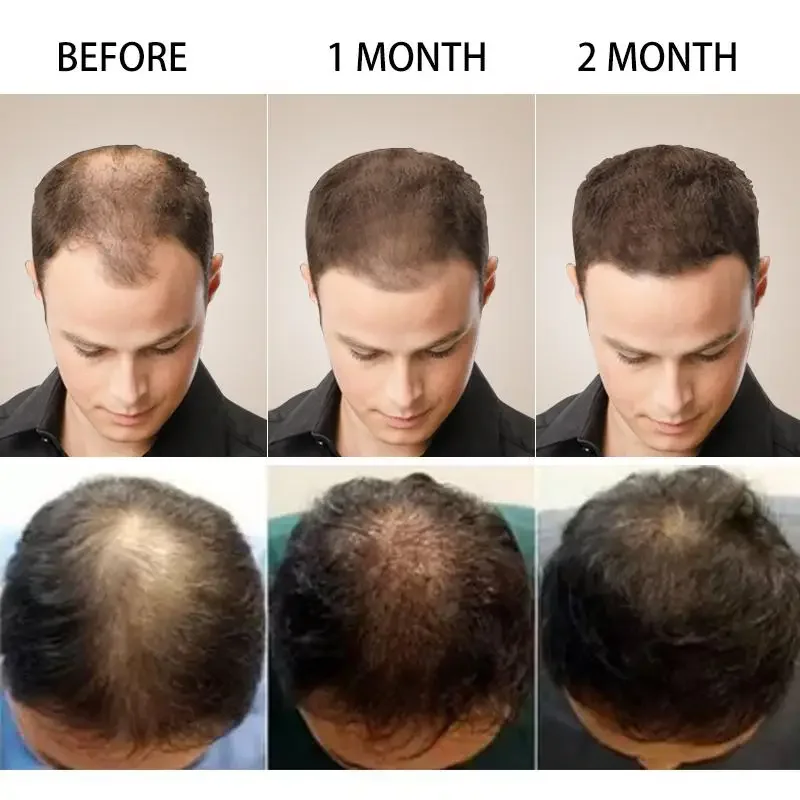 Hair Growth Ginger Fast Growin - Hair Care Oil Serum review and price