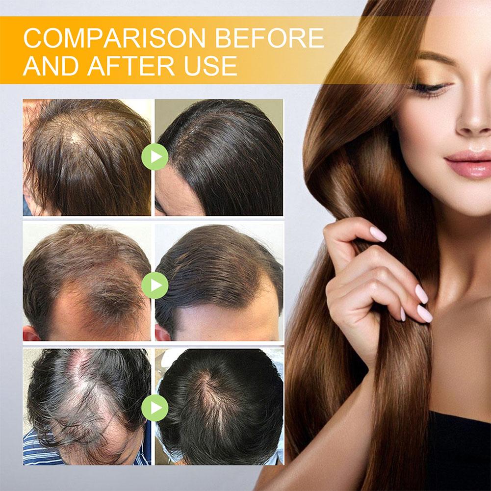 5/3/1pcs Biotin Fast Hair Grow - Hair Care Oil Serum review and price